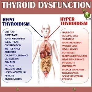Thyroid Disorder prevention