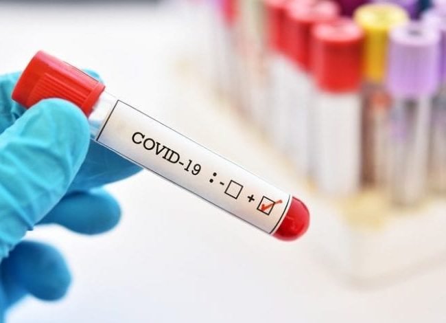 Novel Coronavirus (COVID-19)-Symptoms and Prevention