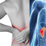 Kidney pain vs. back pain Symptoms and Treatment