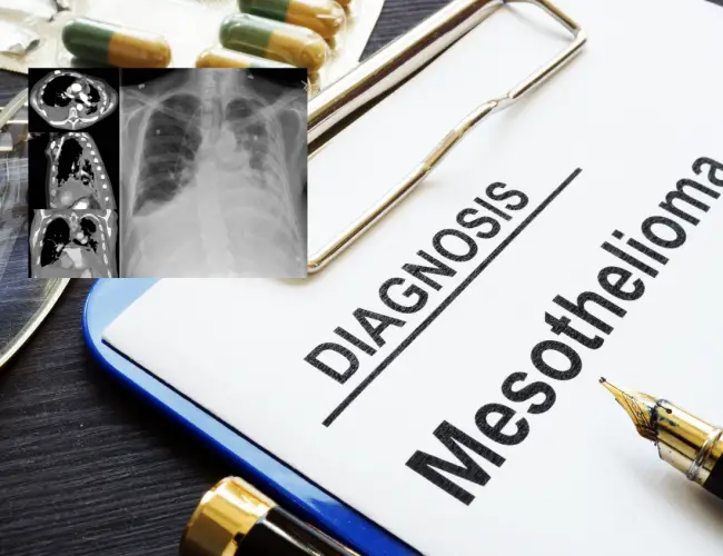 How Do You Get Mesothelioma cancer?