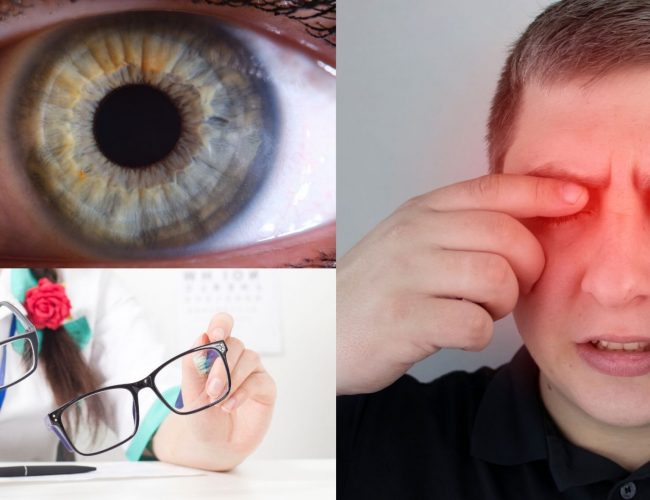 Uveitis: Causes, symptoms, and treatment